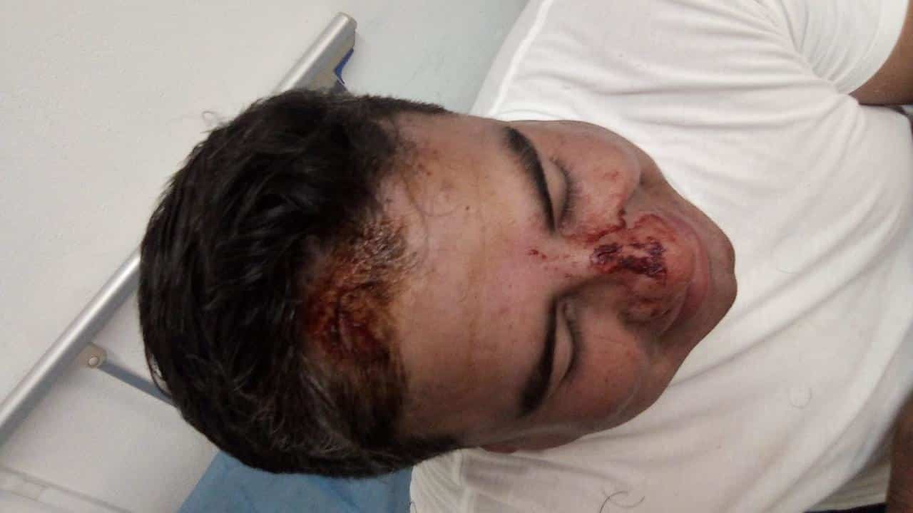 El conductor de una motocicleta fue detenido, ya que, al ser intervenido para su inspección, se negó a la actuación del oficial de vialidad y lo lesionó con un casco desviándole el tabique y provocándole una herida de consideración en la cabeza, en calles de la Colonia La Unidad.