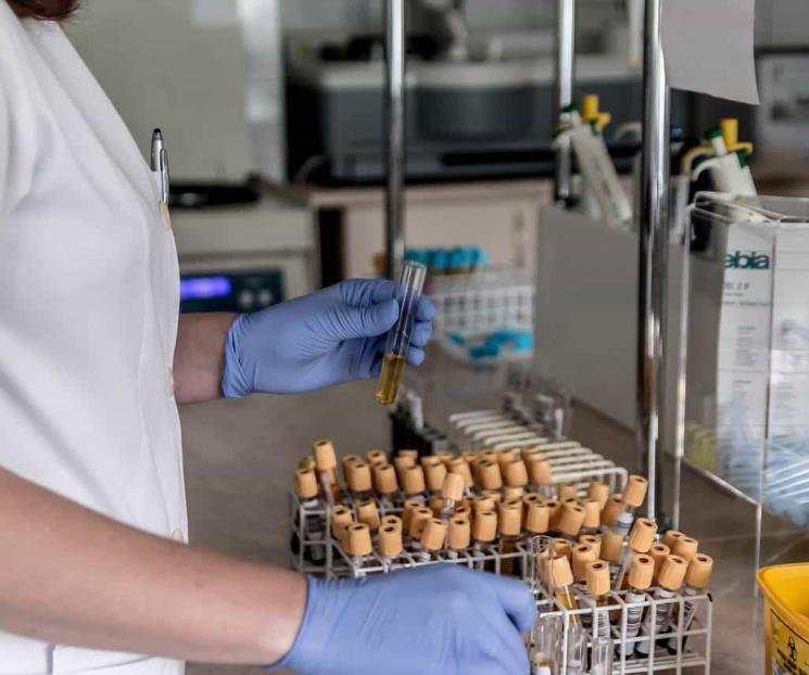 Presencia de orina oscura puede ser un motivo de preocupación