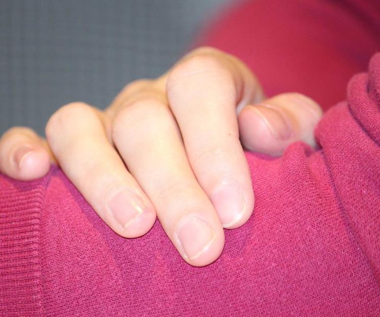 Remedios naturales que curan los hongos de las manos