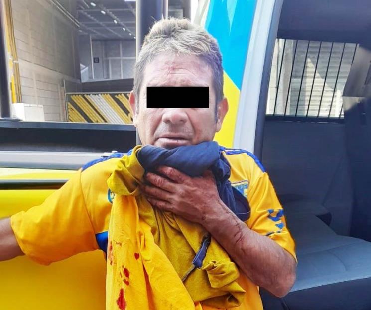 Acuchilla a su ex pareja en estética