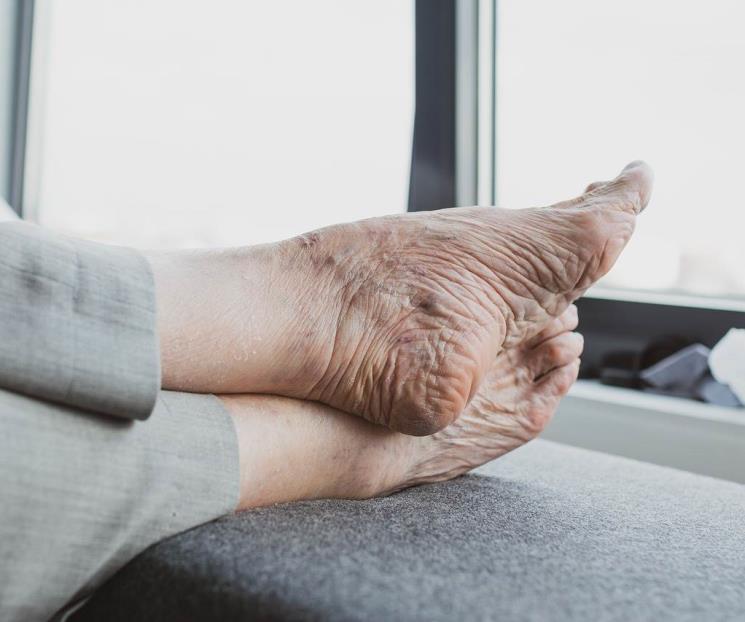 Hábitos que mejoran la salud de un pie diabético, según expertos