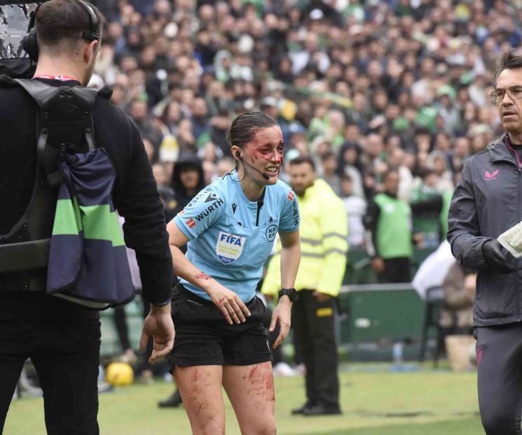 Arbitra se retira de partido en España por chocar con una cámara