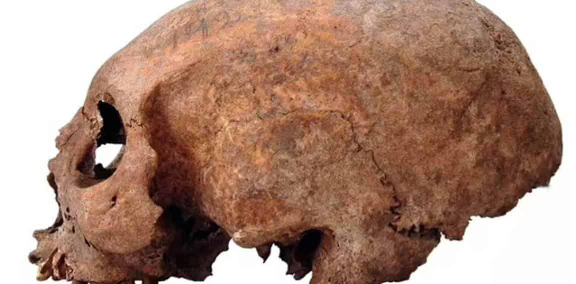 Estudio sugiere que los vikingos ya hacían cirugías plásticas Estudio sugiere que los vikingos ya hacían cirugías plásticas