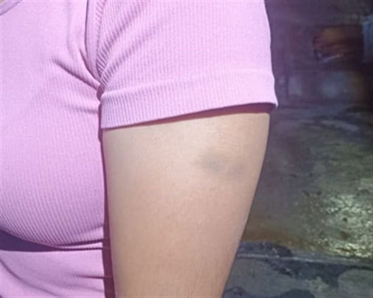 imagen-cuerpo imagen-cuerpo
