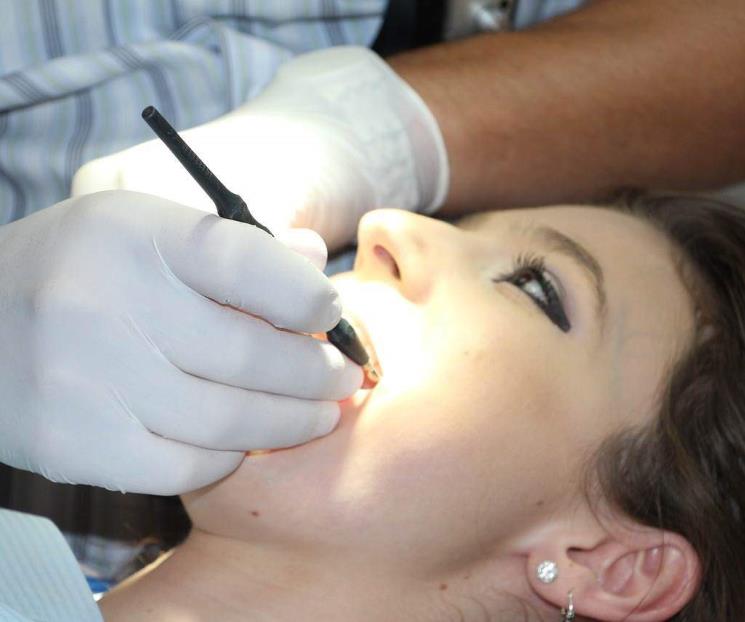 Así puedes eliminar el sarro de los dientes, según especialistas Así puedes eliminar el sarro de los dientes, según especialistas