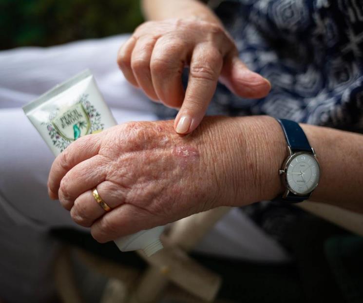 Beneficios de este suplemento para mejorar la salud articular Beneficios de este suplemento para mejorar la salud articular