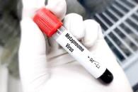 HMPV no representa riesgo para México: Ssa HMPV no representa riesgo para México: Ssa