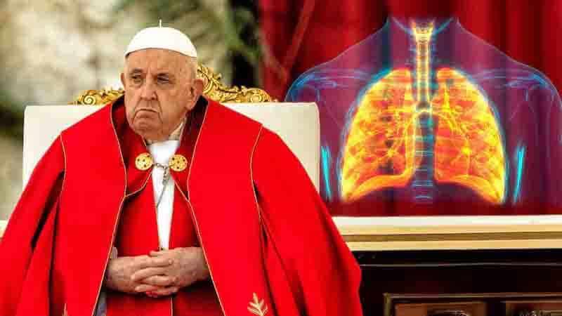 Empeora la salud del Papa: tiene neumonía bilateral