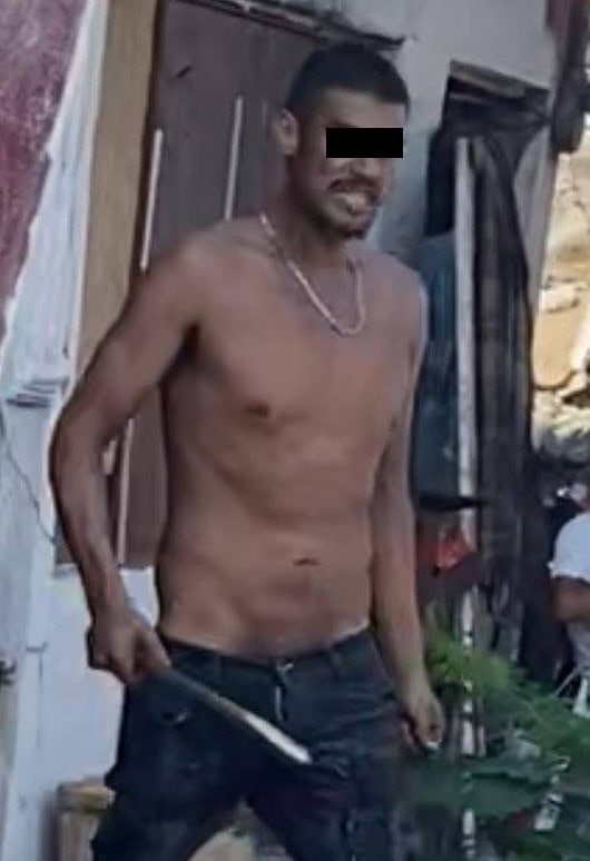 Un hombre fue detenido por oficiales de la Policía de Monterrey, al presuntamente ordenarle a su perro de la raza Pitbull que atacara a una vecina causándole diversas lesiones, en la Colonia Argentina.