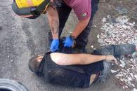 Hallan un lesionado en Anillo Periférico