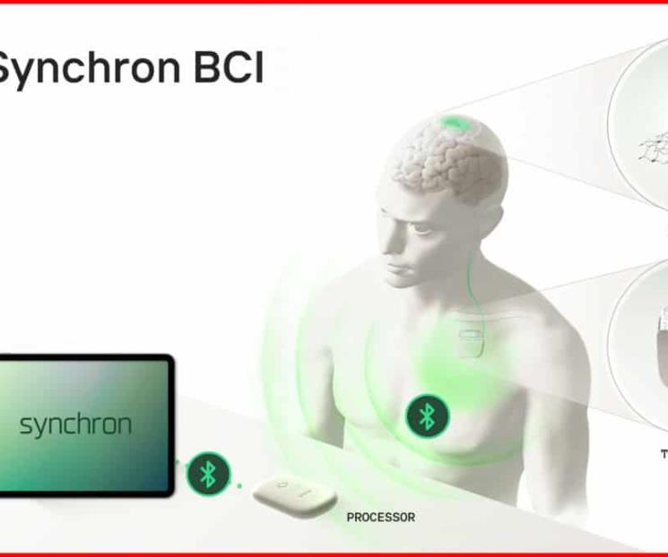 Apple está desarrollando una interfaz cerebro-dispositivo Apple está desarrollando una interfaz cerebro-dispositivo