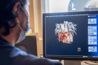 Corazones en la mira: TecSalud reconocido en tratar falla cardiaca Corazones en la mira: TecSalud reconocido en tratar falla cardiaca