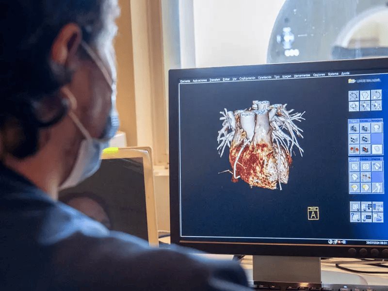 Corazones en la mira: TecSalud reconocido en tratar falla cardiaca