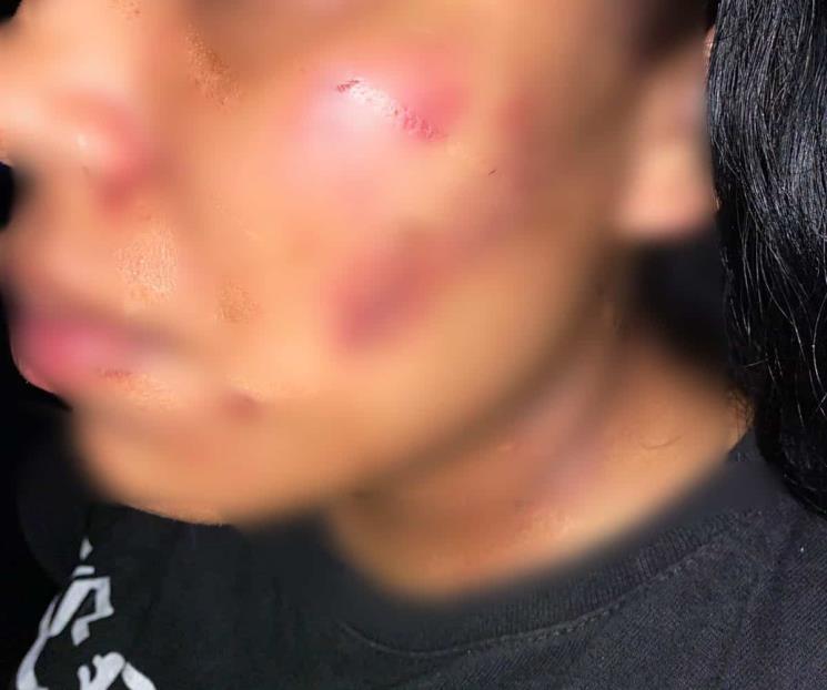 Agrede a su esposa; lo detienen