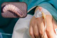 Se registran 31casos de miasis por gusano barrenador en humanos: Ssa