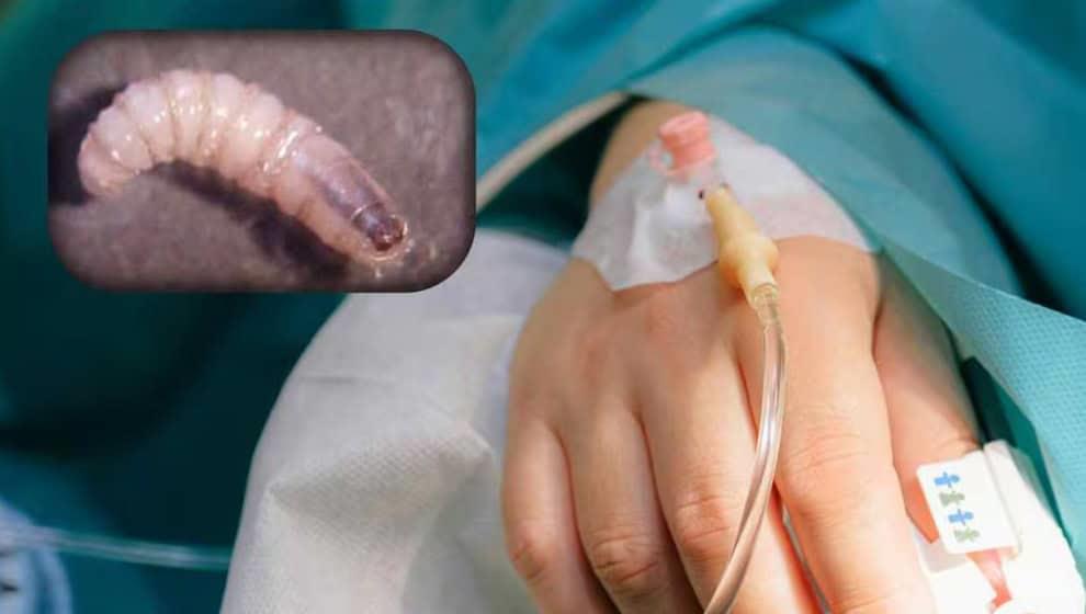 Se registran 31casos de miasis por gusano barrenador en humanos: Ssa