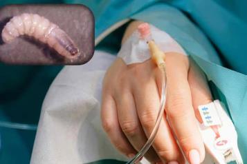 Registran 31 casos de gusano barrenador en seres humanos