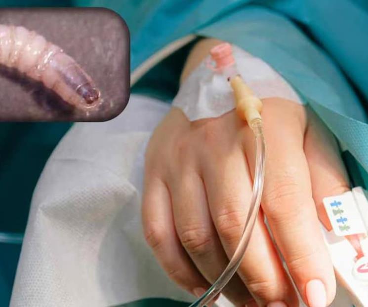 Registran 31 casos de gusano barrenador en seres humanos