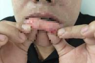 Agrede joven a su exnovia Agrede joven a su exnovia