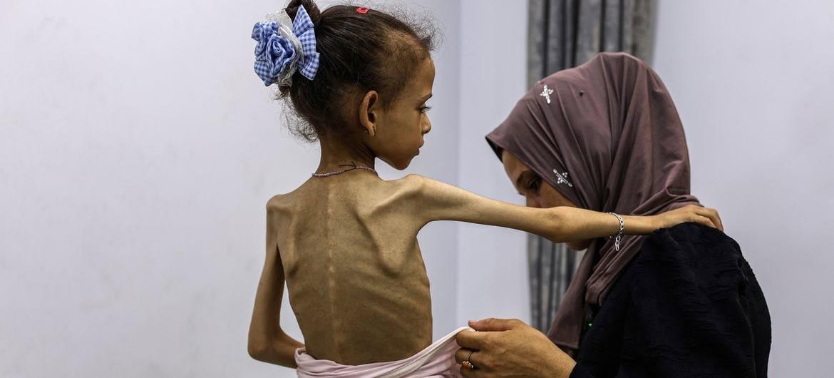 Declara ONU oficialmente ´hambruna´ en Gaza Declara ONU oficialmente ´hambruna´ en Gaza