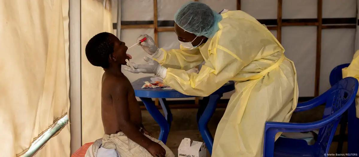Declara OMS que mpox deja de ser urgencia de salud pública Declara OMS que mpox deja de ser urgencia de salud pública