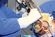 Realiza Semar primeras cirugías de Parkinson con nueva tecnología