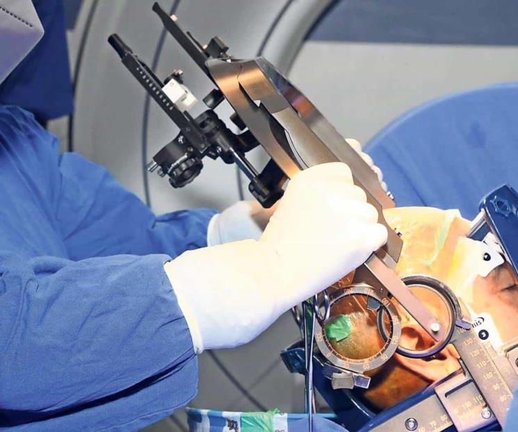Realiza Semar primeras cirugías de Parkinson con nueva tecnología