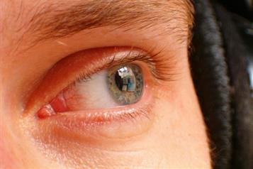 Dile adiós a las ojeras: remedios para dormir sin complicaciones