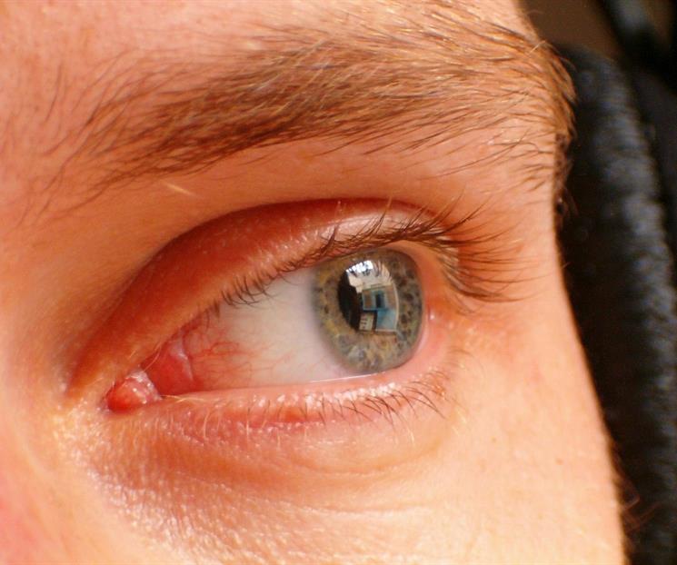 Dile adiós a las ojeras: remedios para dormir sin complicaciones