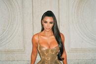 Kim Kardashian fue diagnosticada con un aneurisma cerebral Kim Kardashian fue diagnosticada con un aneurisma cerebral