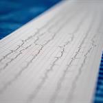 Gen ayuda a reparar el corazón tras un infarto