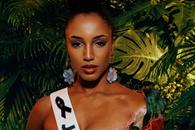 Permanece Miss Jamaica en terapia intensiva