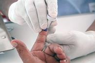 Alerta aumento de casos de VIH en México Alerta aumento de casos de VIH en México