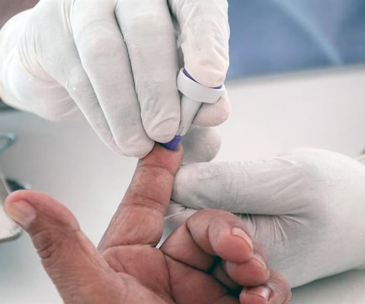 Alerta aumento de casos de VIH en México