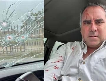 Atacan a candidato presidencial en Perú