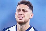 Sufre Ocampos par&aacute;lisis facial