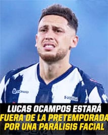 Sufre Ocampos par&aacute;lisis facial