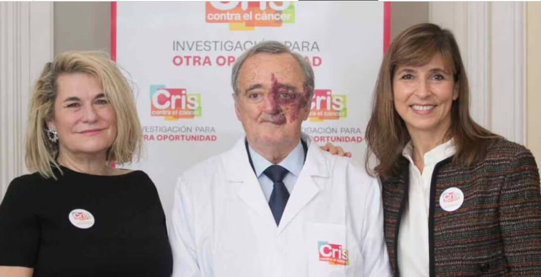 Mariano Barbacid logra curar c&aacute;ncer de p&aacute;ncreas en ratones