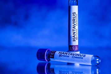 Confirma OMS que ocho casos en brote de hantavirus