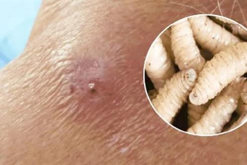 Confirman primer contagio de gusano barrenador de humano en NL