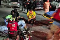 Sufre amputaci&oacute;n en accidente de moto