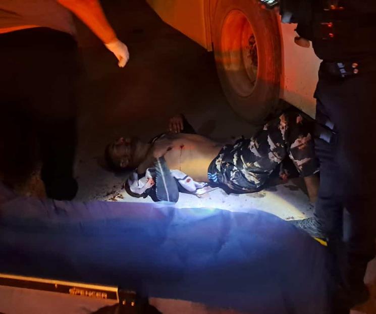 Recibe 11 disparos y vive Recibe 11 disparos y vive