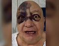 &iquest;Qu&eacute; le paso al comediante Luis de Alba en el rostro?