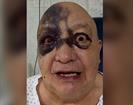 ¿Qué le paso al comediante Luis de Alba en el rostro? ¿Qué le paso al comediante Luis de Alba en el rostro?