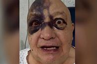 &iquest;Qu&eacute; le paso al comediante Luis de Alba en el rostro?