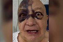 &iquest;Qu&eacute; le paso al comediante Luis de Alba en el rostro?